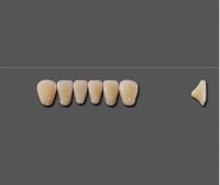 Acrylic dental prosthesis / posterior teeth / anterior teeth