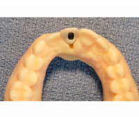 Dental anatomical model
