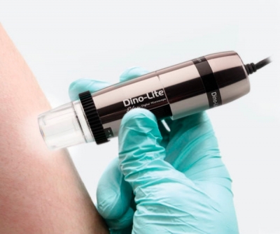 Dino-Lite Dermascope Polarizer HR (MEDL7DW)