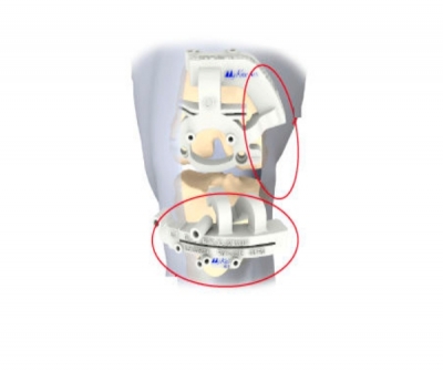 MyKnee MIS
