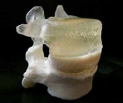 Pediatric Spine