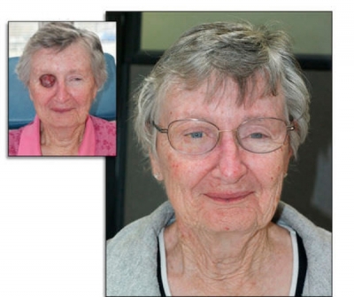 RealLifeSkin™
