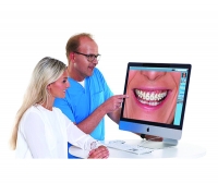 Romexis® Smile Design