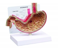 2000 Stomach with ulcers